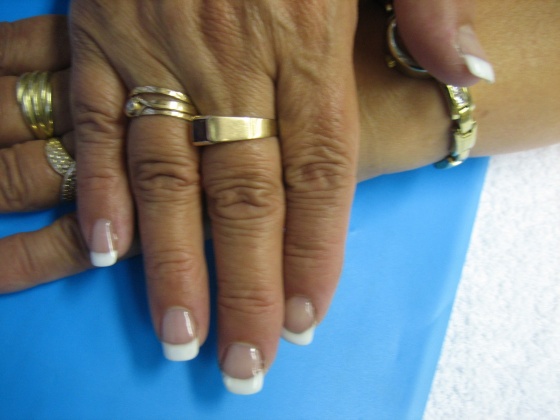 Judyt - Zselés - 2010-06-18 12:20
